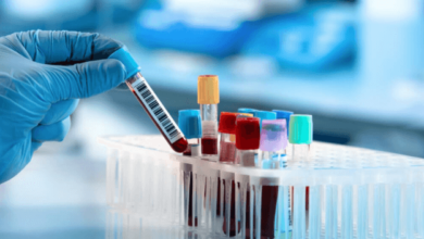 Laboratory Services: How They Provide Critical Insights for Healthcare