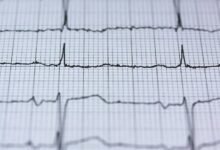 revenue generation from fusion